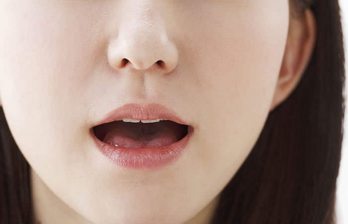 むし歯の原因は