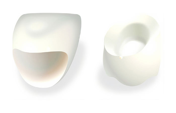 セラミックの詰め物・被せ物