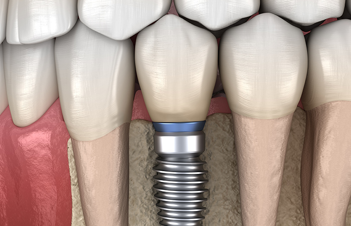 すべての方に適用できるわけではない