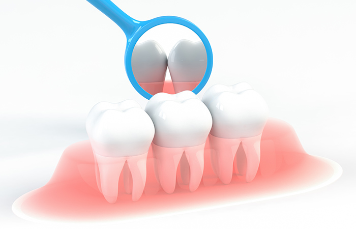 その他のトラブル