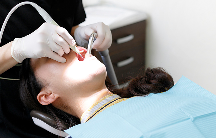 詰め物・被せ物の除去