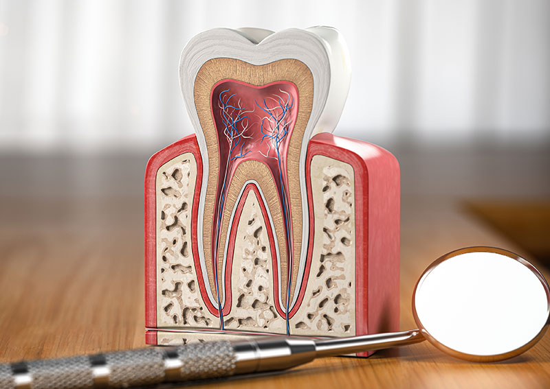 根管治療（歯内療法）